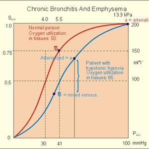 Phlemn - Brochitis Disease