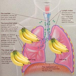 Bronchitis Home Remedy - Bronchitis Symptoms Indicators - The Way To Identify Them For Early Diagnosis