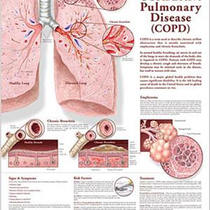 Something You Must Know About COPD